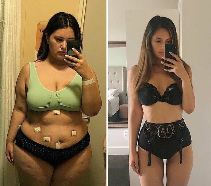 Menina antes e depois da perda de peso com cápsulas KETO Complete